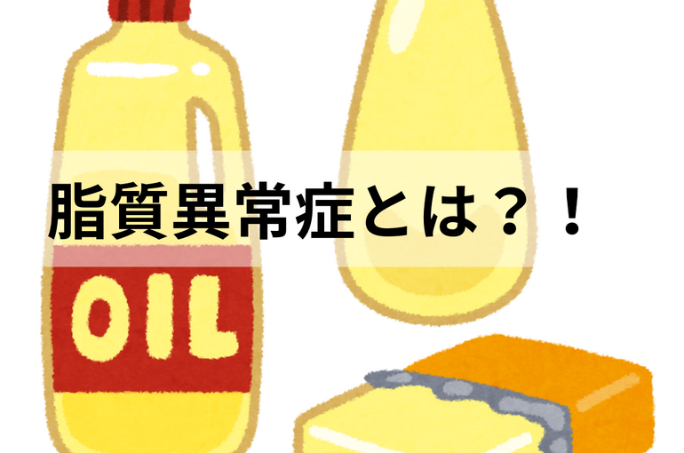 オススメ ハンバーガー